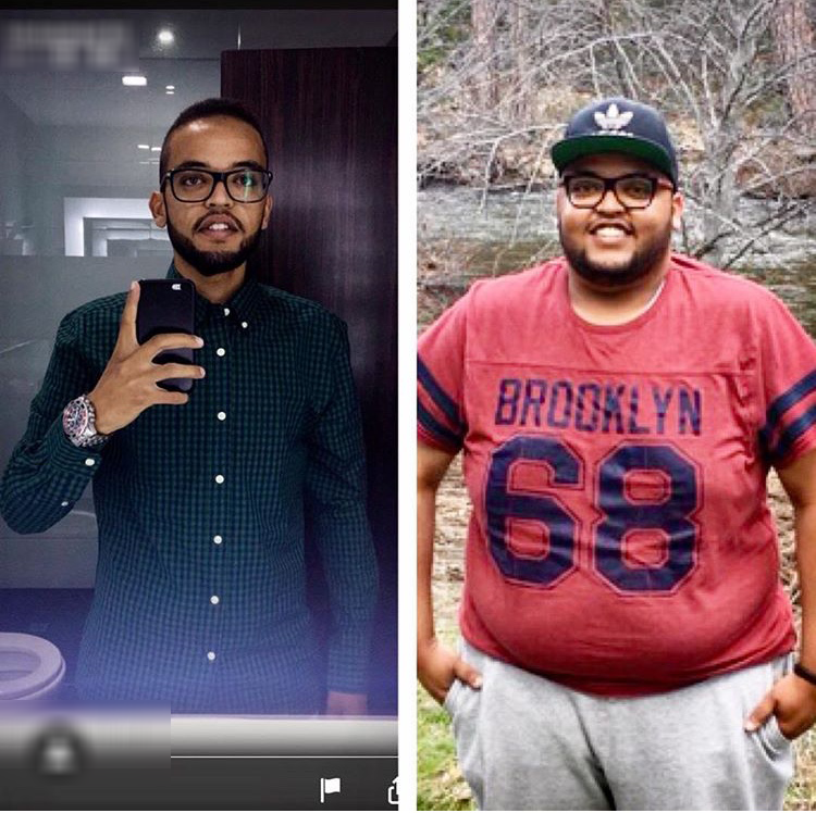 soma bariatrics weight loss before after