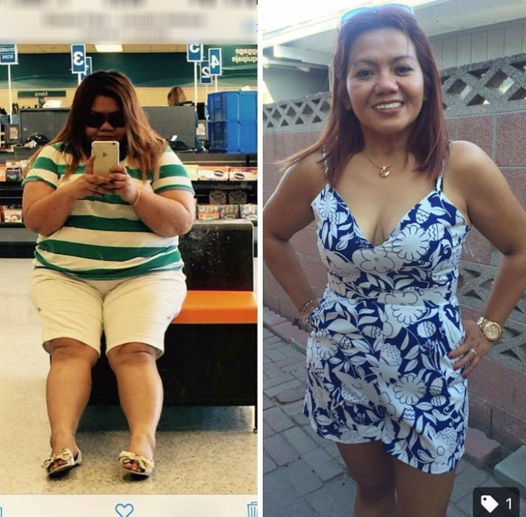 soma bariatrics weight loss before after